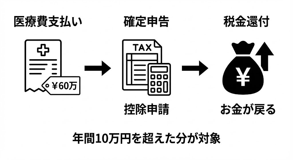 医療費控除によって税金が還付される仕組みのフローチャート図。支払いから確定申告を経て還付金が戻るまでの流れ。